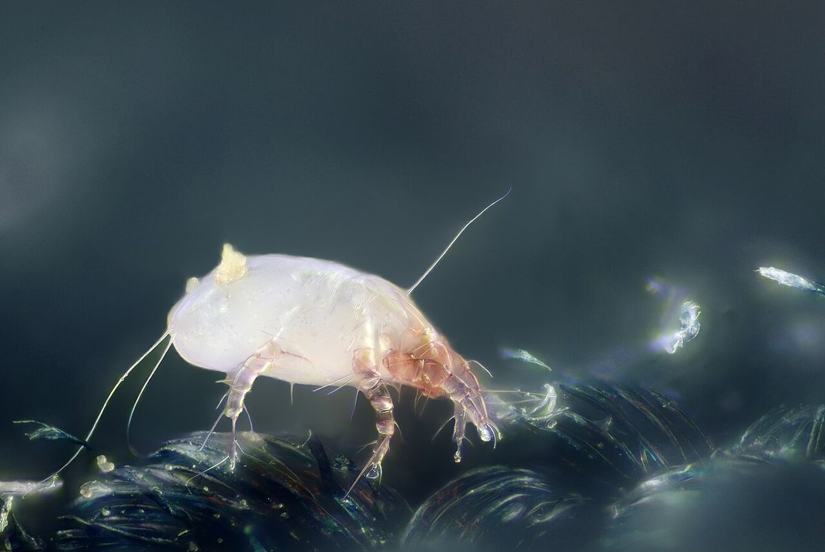 집먼지진드기(Dermatophagoides pteronyssinus) 확대 사진